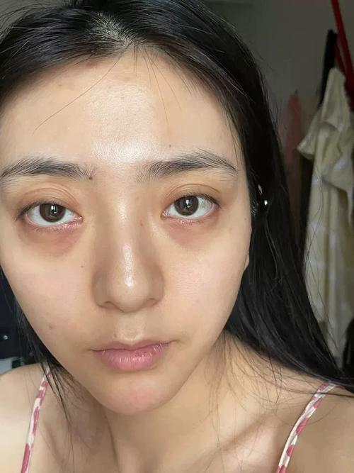 重度黑眼圈遮瑕_熬夜黑眼圈？橘色遮瑕是救星！