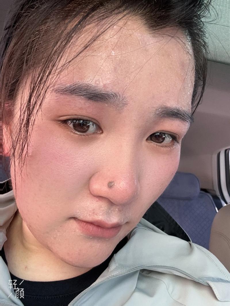 脸爱出汗不适合化妆_夏天出汗不化妆好处多，防盐分残留勤清洁