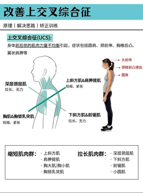 深层颈屈肌训练动作_增强颈部力量，预防颈椎病，5个动作教你练好深层颈屈肌