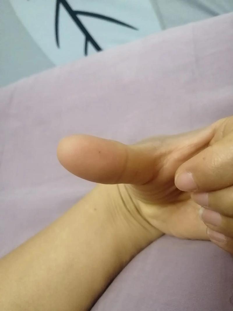 手上扎进头发小妙招_手指头发扎进去了?教你简单处理方法! 手上扎进头发小妙招_手指头发扎进去了?教你简单处理方法!