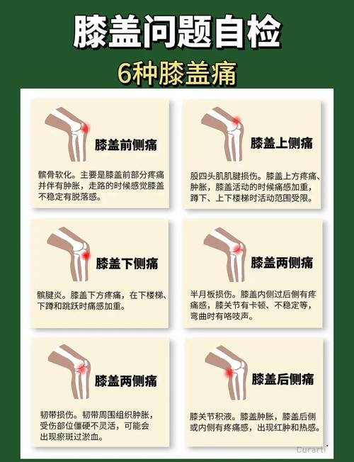 腿弯疼痛部位对照表_肌筋膜炎坐骨神经痛等