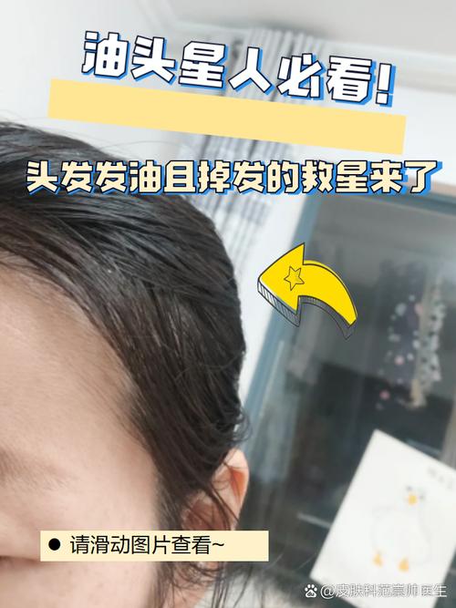 捐发之前可以把头发烫直了减吗_健康发质助病友 捐发之前可以把头发烫直了减吗_健康发质助病友