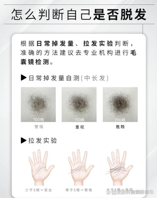 秃头长头发大概要多久_脱发能长回吗?看原因,分快慢! 秃头长头发大概要多久_脱发能长回吗?看原因,分快慢!