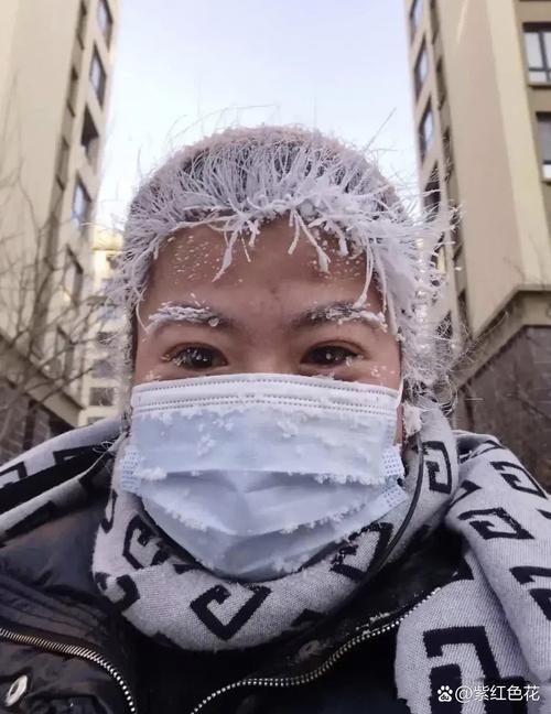 带安全帽时间久了头发少了_戴安全帽真掉头发？别信！