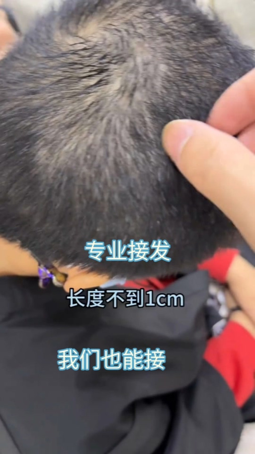 八厘米的头发需要留多长时间_留八厘米头发要多久?护理很重要! 八厘米的头发需要留多长时间_留八厘米头发要多久?护理很重要!