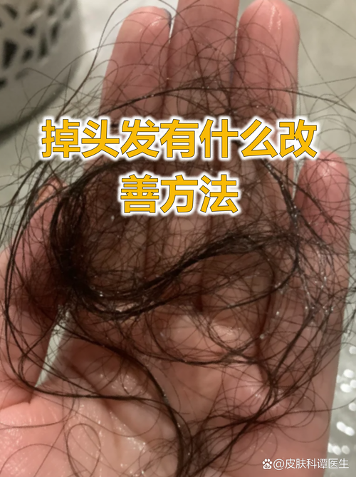 戒掉熬夜头发会长回来吗_熬夜掉发别慌，调整作息或可恢复！