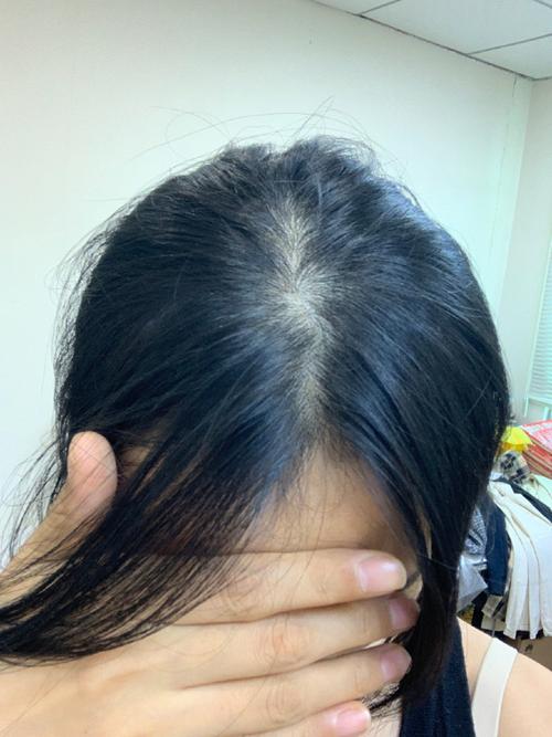 一抹头发就掉几根_脱发增多？压力营养头皮是关键！
