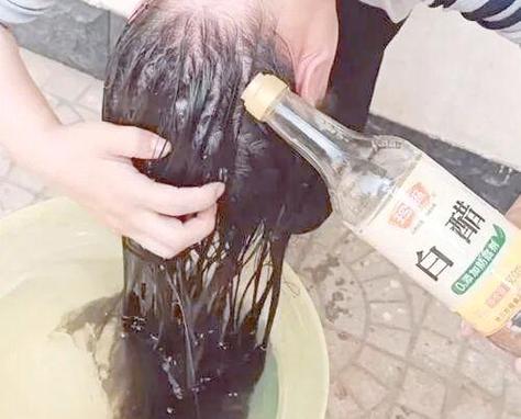 陈醋洗头发的正确方法_陈醋水洗头,清爽去屑,每周1-2次 陈醋洗头发的正确方法_陈醋水洗头,清爽去屑,每周1-2次