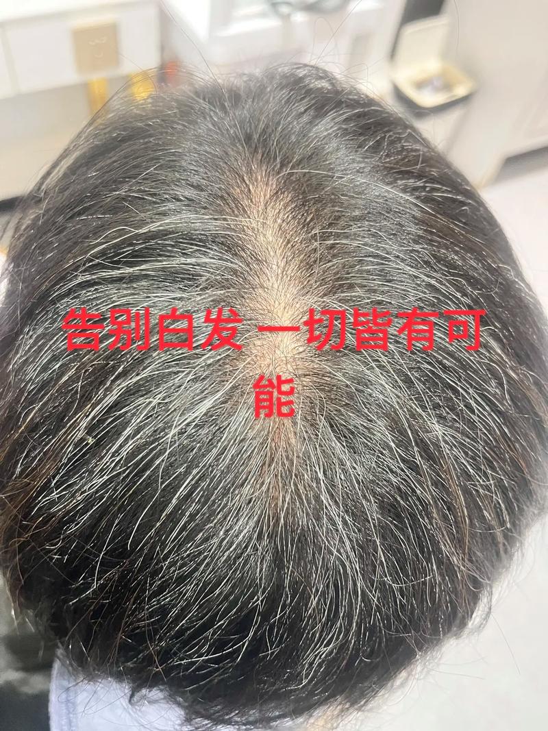 茶粉养发能把白头发变过来吗_茶粉养发效果有限，别当白发克星