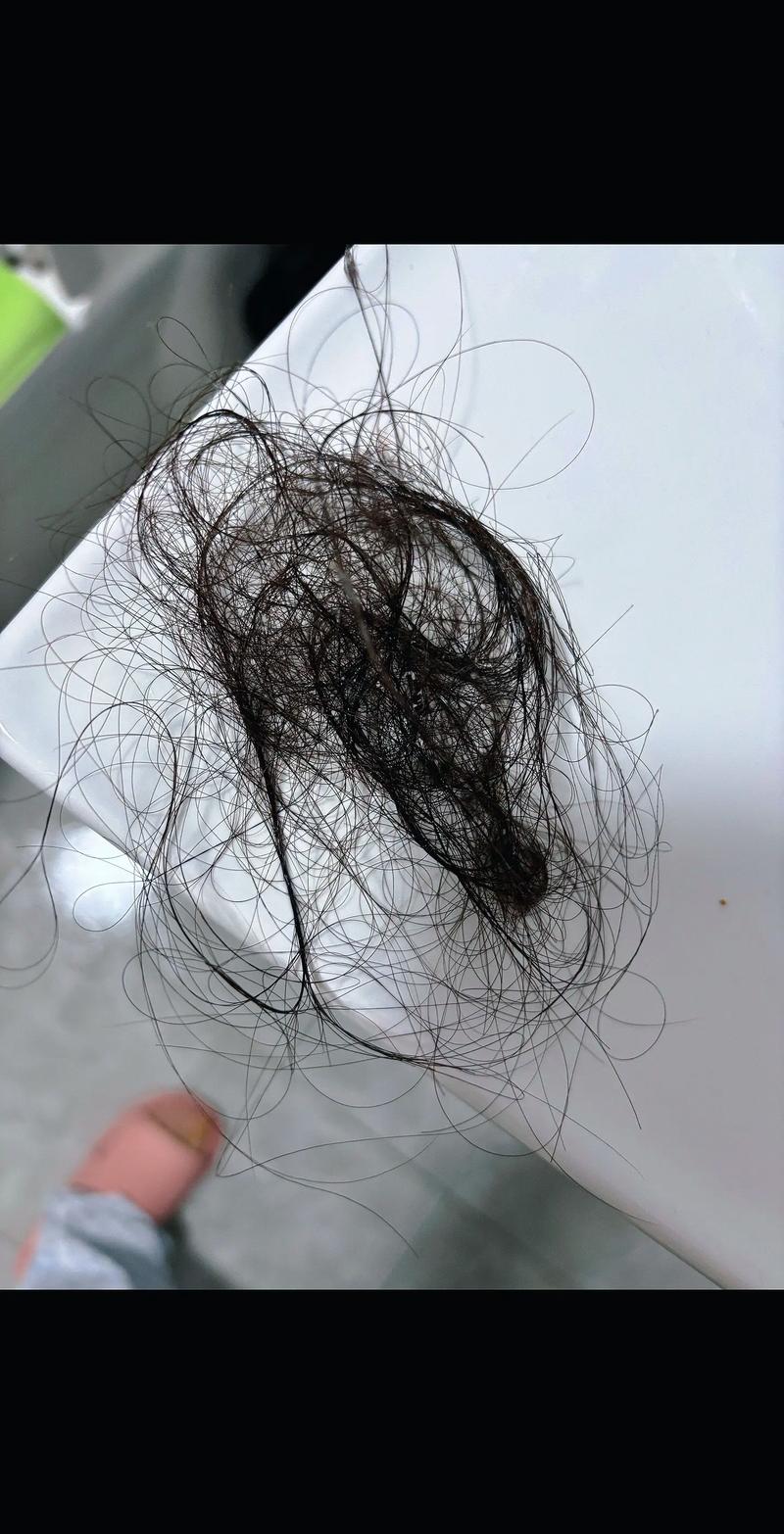 被人使劲拽头发后脱发严重_拉扯伤发根,压力大营养差要当心! 被人使劲拽头发后脱发严重_拉扯伤发根,压力大营养差要当心!