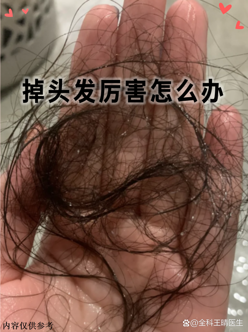 被人使劲拽头发会脱发吗_扯头发伤毛囊会脱发，轻柔护理是关键