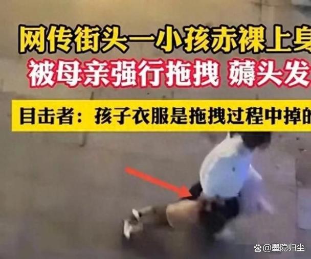 扯女生头发的后果_别总扯头发,小心变秃头! 扯女生头发的后果_别总扯头发,小心变秃头!