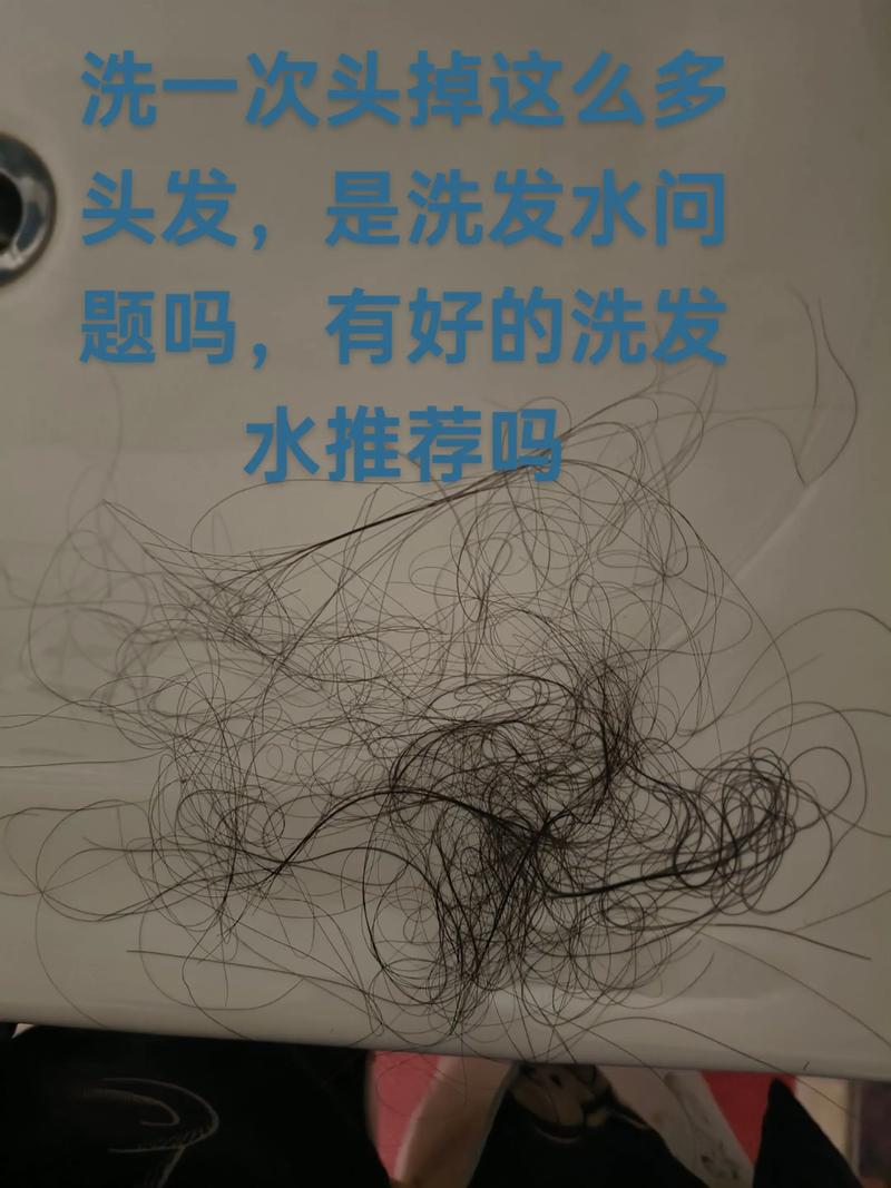 一梳头发就掉30根洗头时又掉_脱发增多？快查查原因！