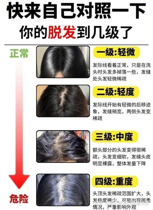 家里有女人的头发能查是谁吗_不明头发查得到是谁吗？看毛囊！