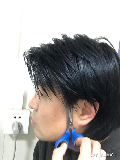 俩鬓头发长特别快_遗传生理影响发快,毛多需查,好习惯助健康长 俩鬓头发长特别快_遗传生理影响发快,毛多需查,好习惯助健康长