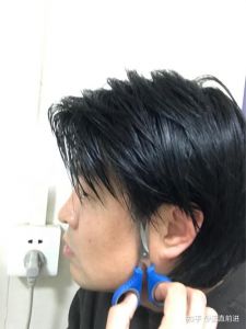 俩鬓头发长特别快_遗传生理影响发快，毛多需查，好习惯助健康长