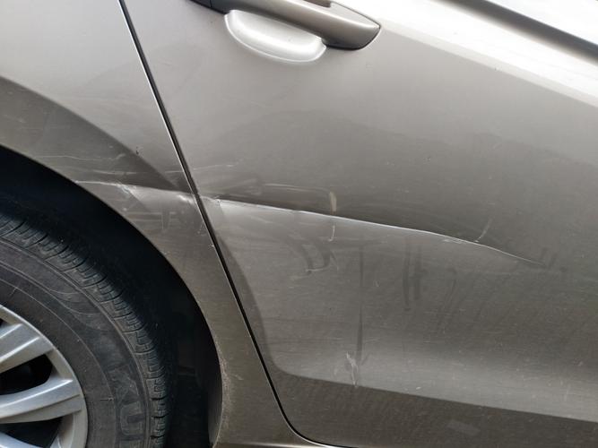 皮肉擦伤有点深看到灰色是什么_伤口变灰？别慌，可能是这几种情况！