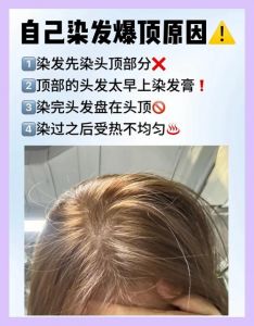 经期能不能染头发_经期染发易紊乱？选温和品通风做，保暖清淡好