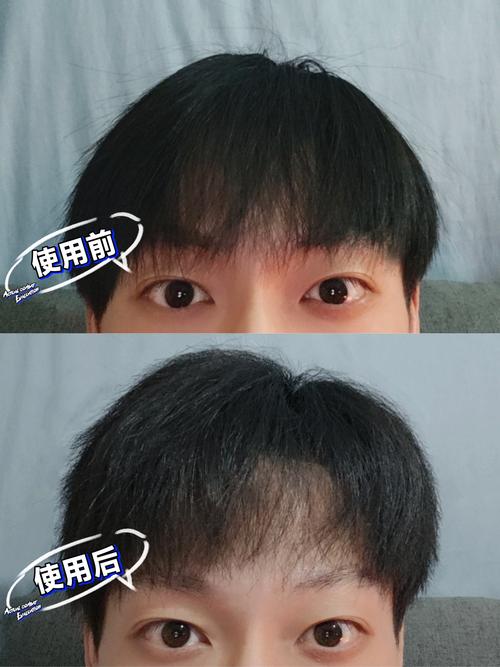 发泥不洗掉会伤头发吗_发泥残留伤头皮,用对才护发 发泥不洗掉会伤头发吗_发泥残留伤头皮,用对才护发