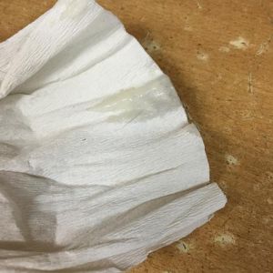 流出来的白色液体是什么_女性白带正常与异常解析及预防